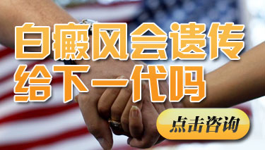 白癜风的危害常见的有哪些 白癜风的危害常见的有哪些