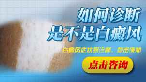 白癜风的诊断方法有哪些 白癜风的诊断方法有哪些