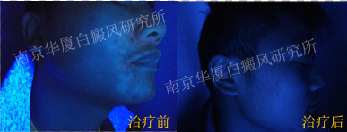 ഺ꣬ư