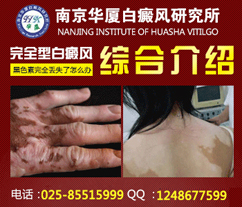 手部白癜风怎么治疗才好
